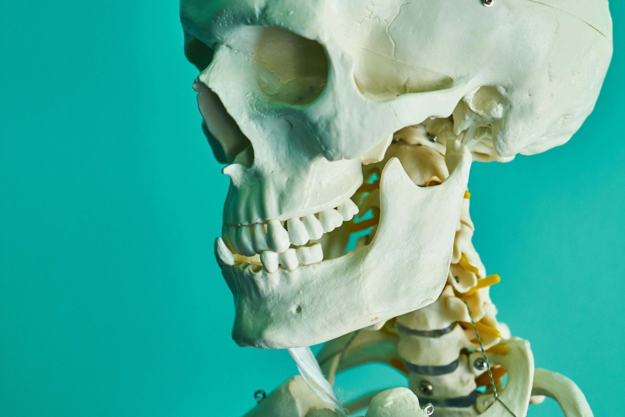 Misalignment of the Teeth or Jaw