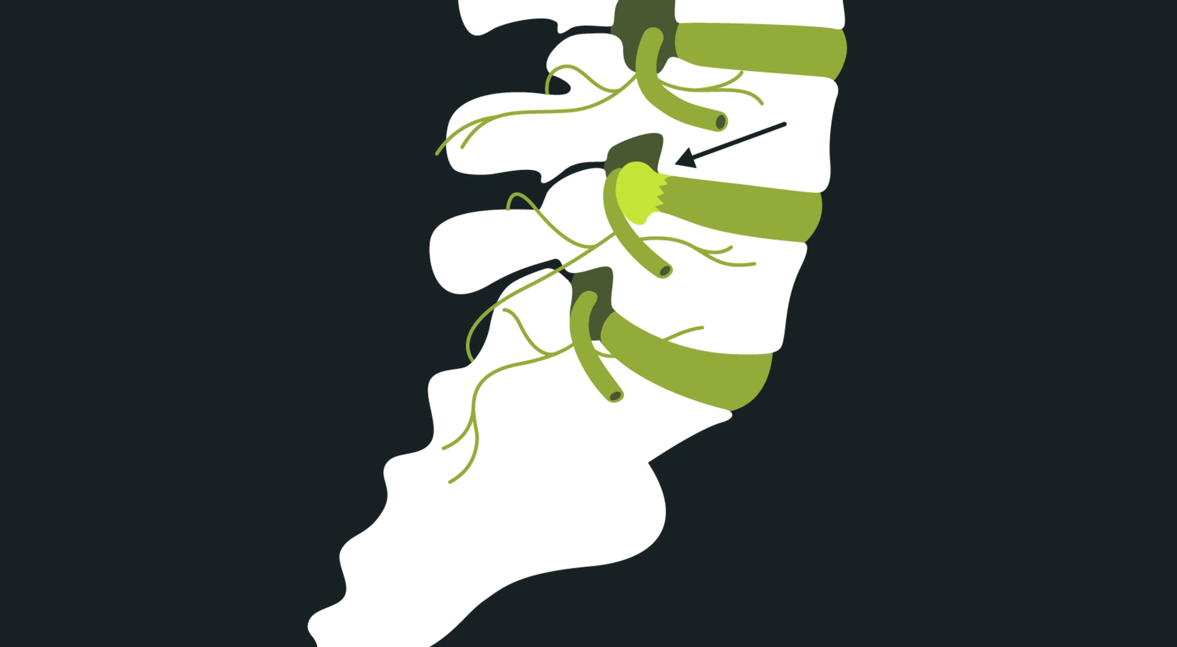 https://storage.googleapis.com/oneworld-prod/assets/anatomie-bandscheibe-lendenwirbel-kreuzbein-blackroll.jpg?v=1603361125