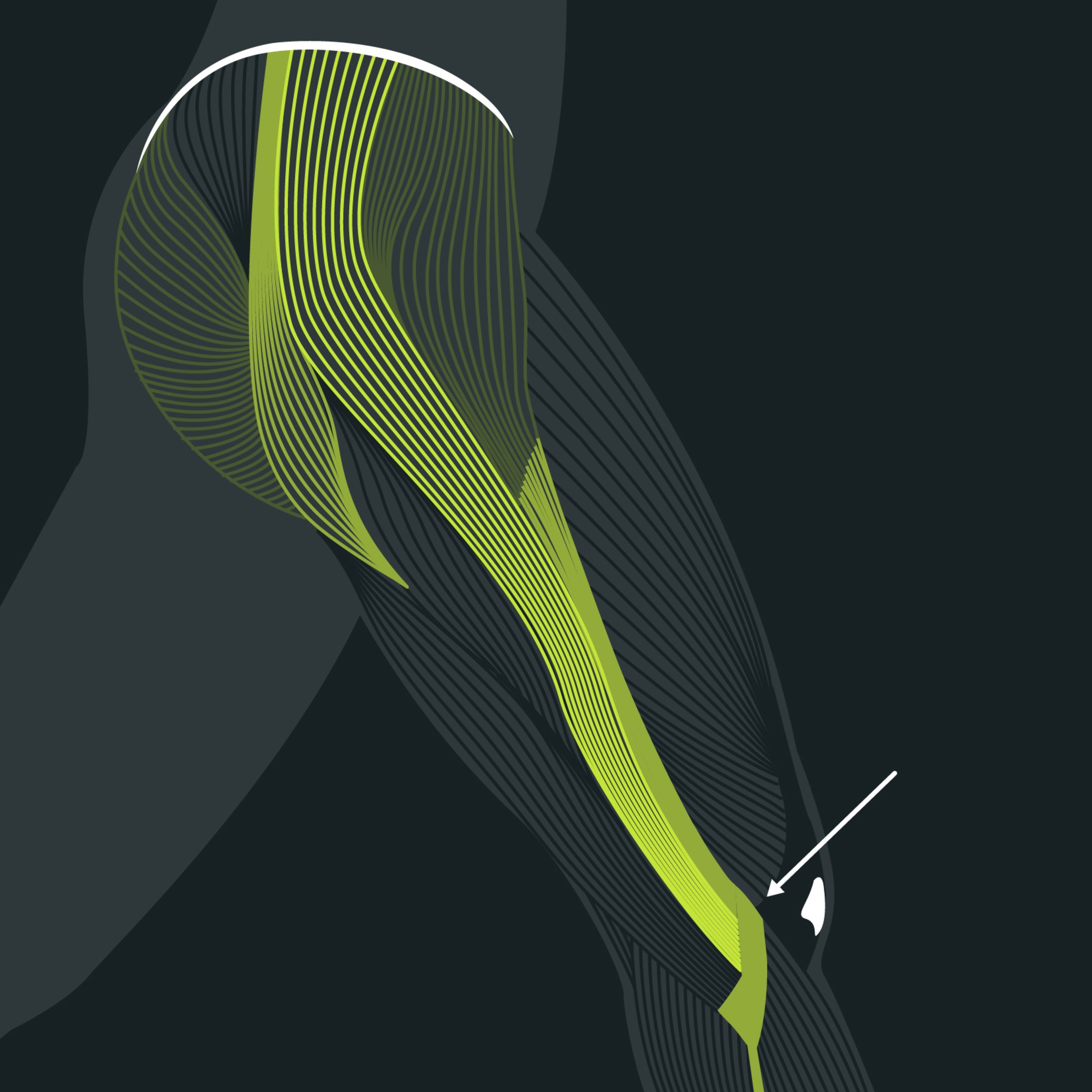 Anatomie du genou du coureur (ITBS)