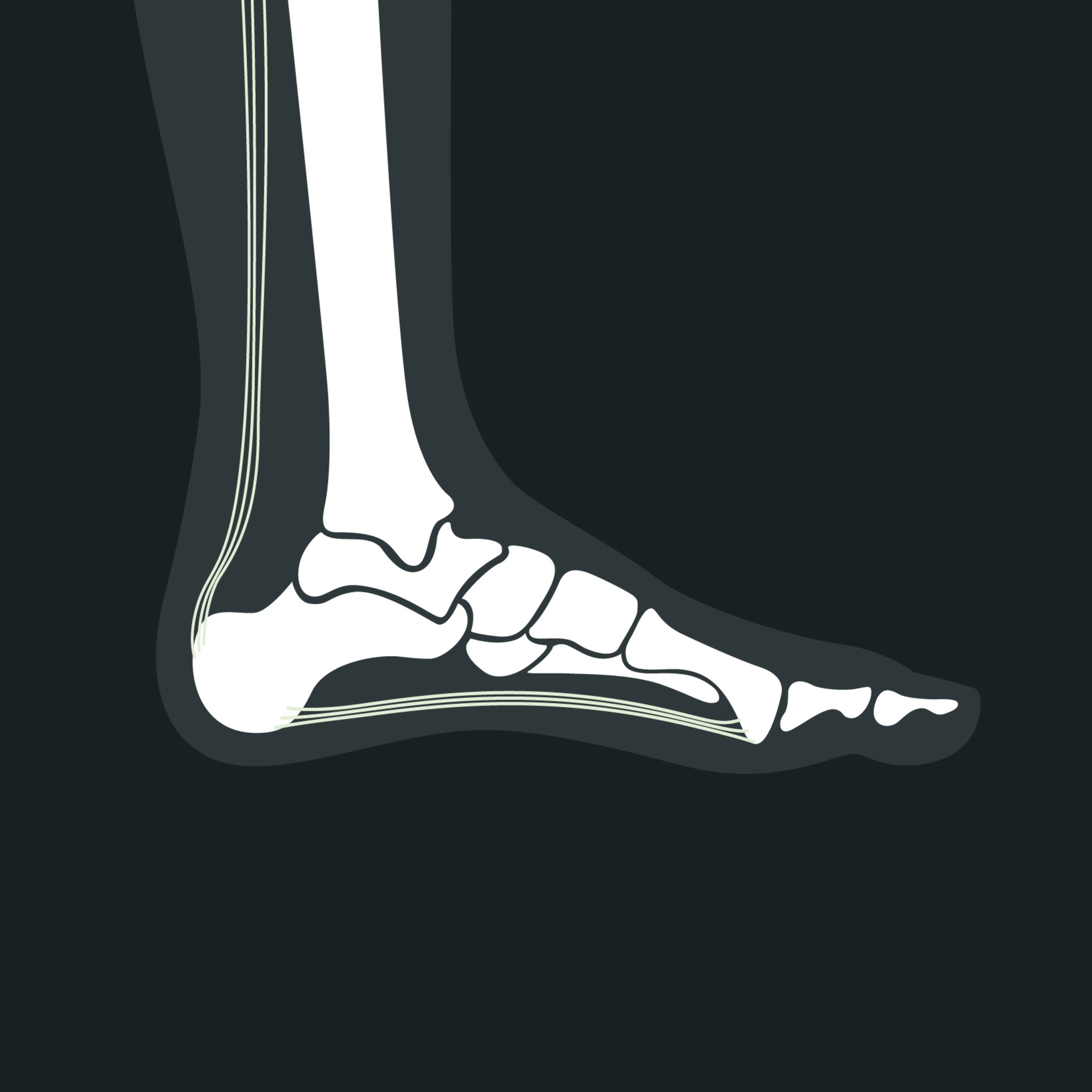 Anatomy of a Healthy Heel