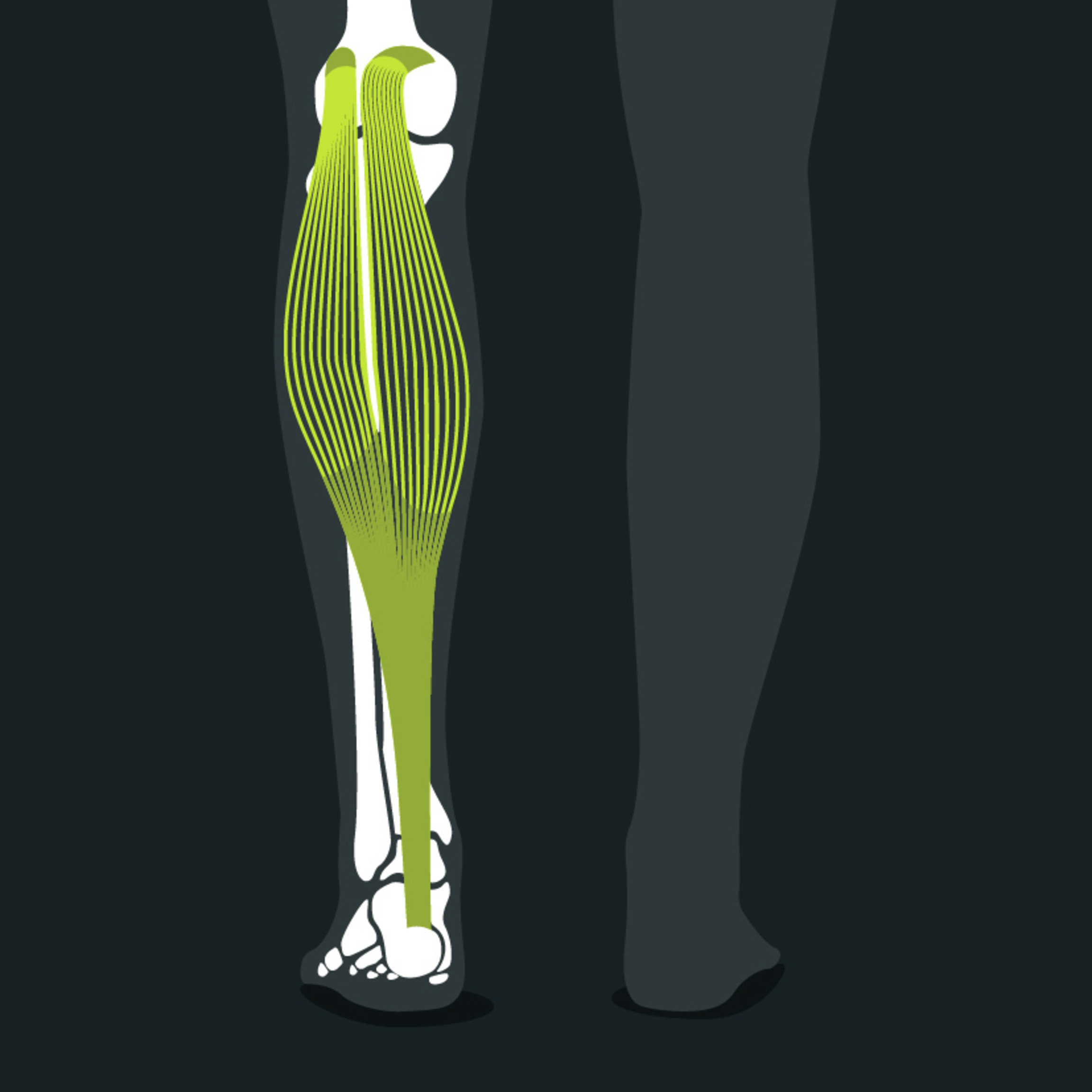 Représentation anatomique des muscles du mollet : gastrocnémien, soléaire et plantaire
