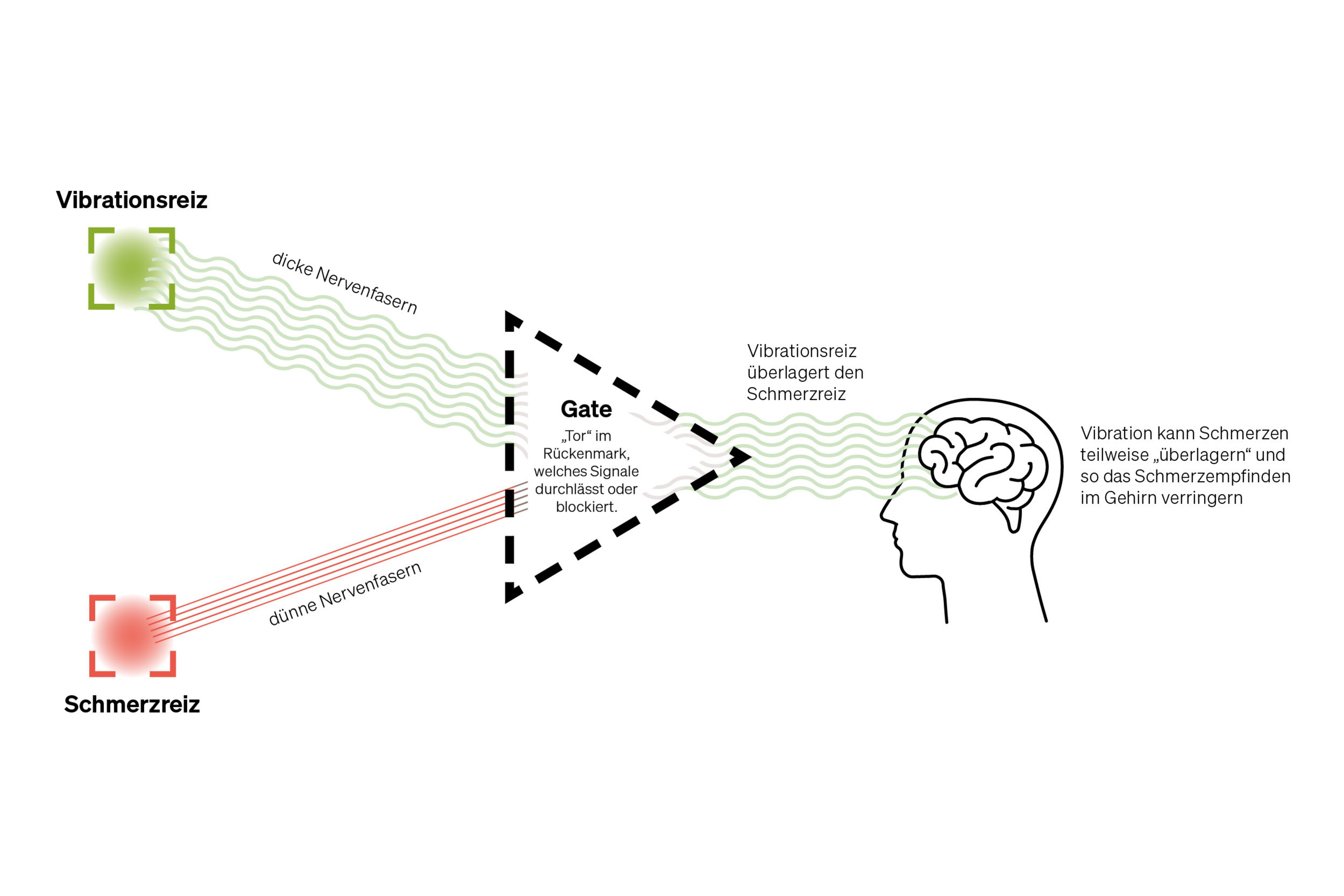 Pain Gate Diagram