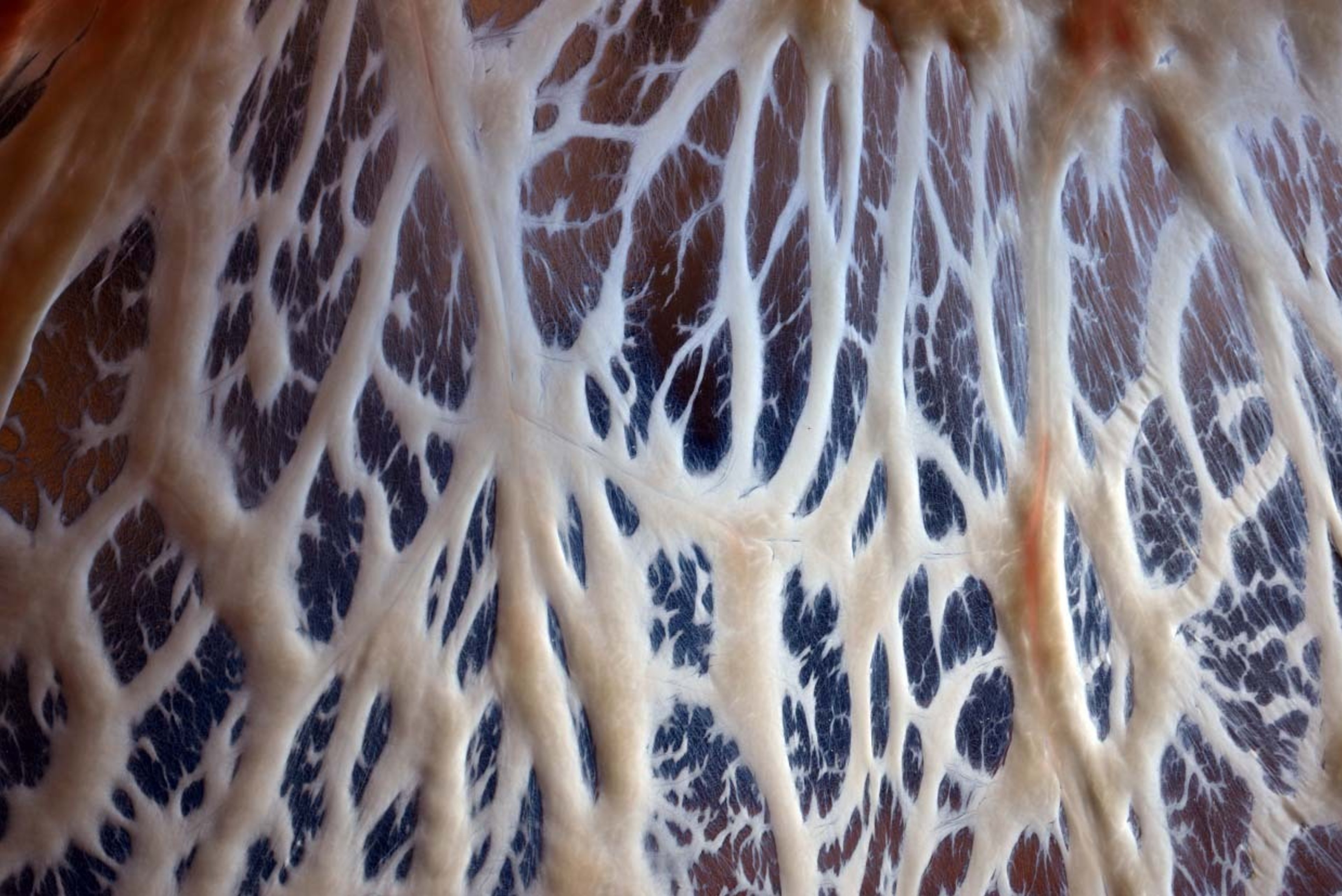 Fascia in de praktijk