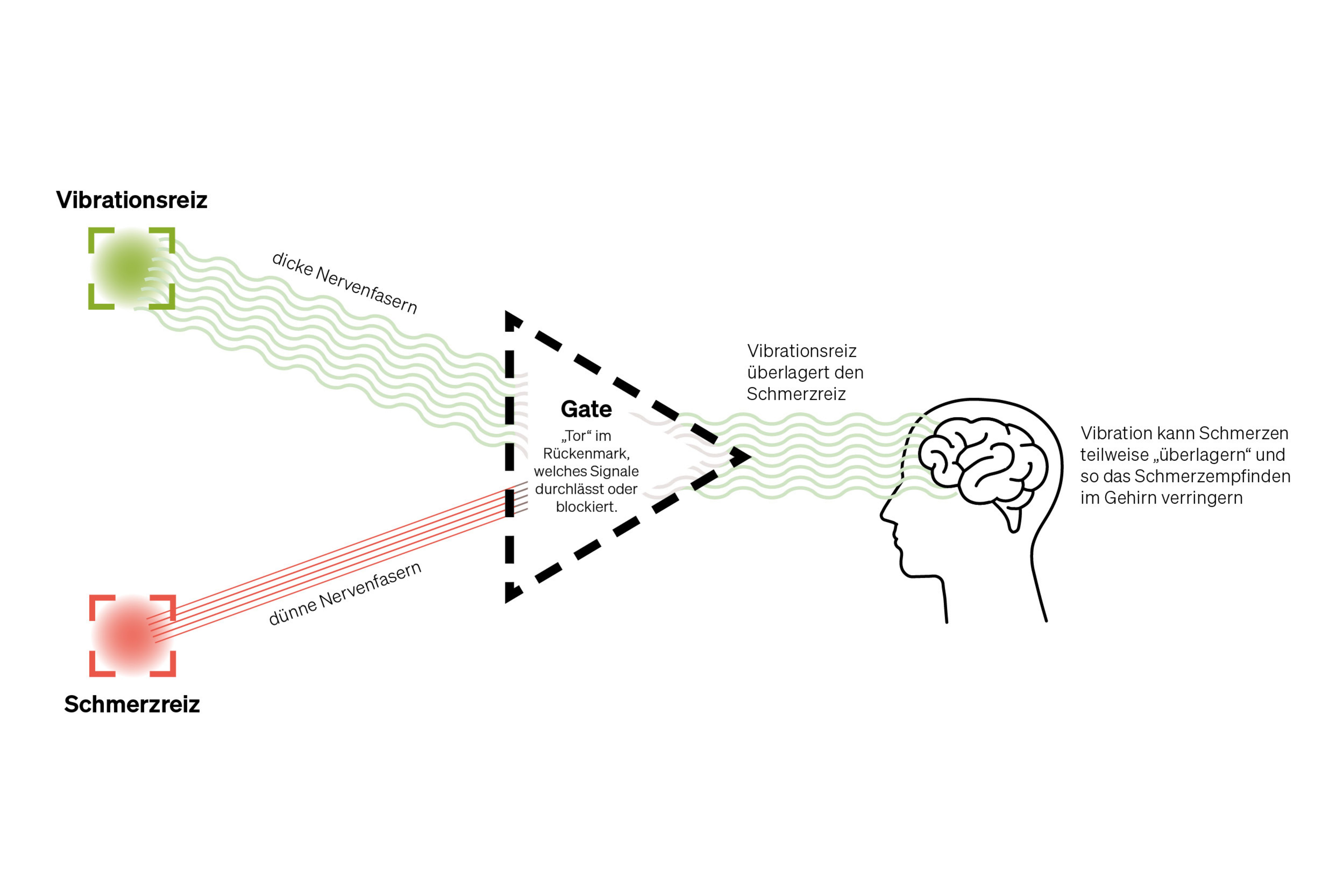 Pain Gate Diagram