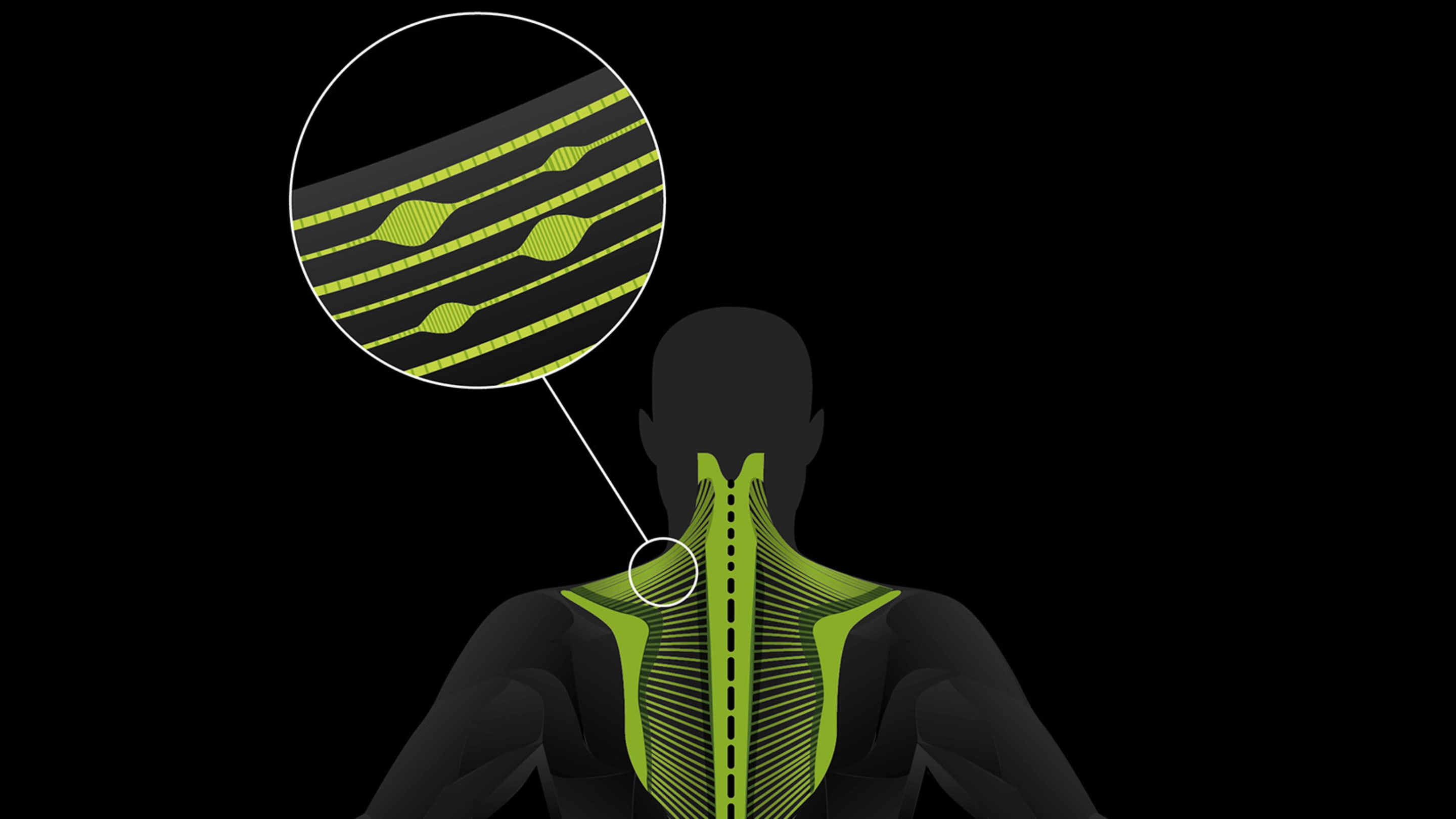 Triggerpunkte Fasziengewebe