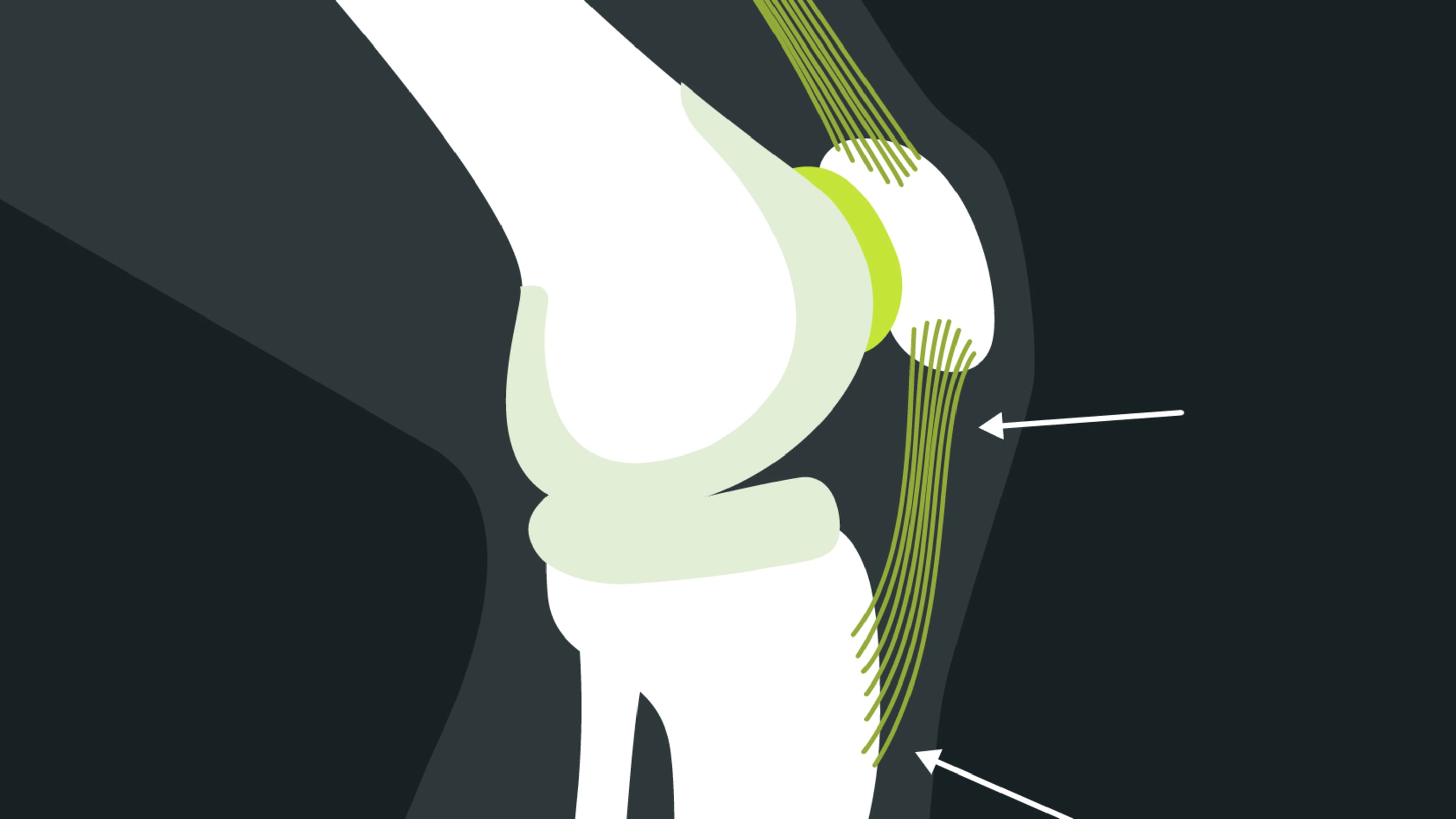 Anatomie patellaspitzensyndrom blackroll