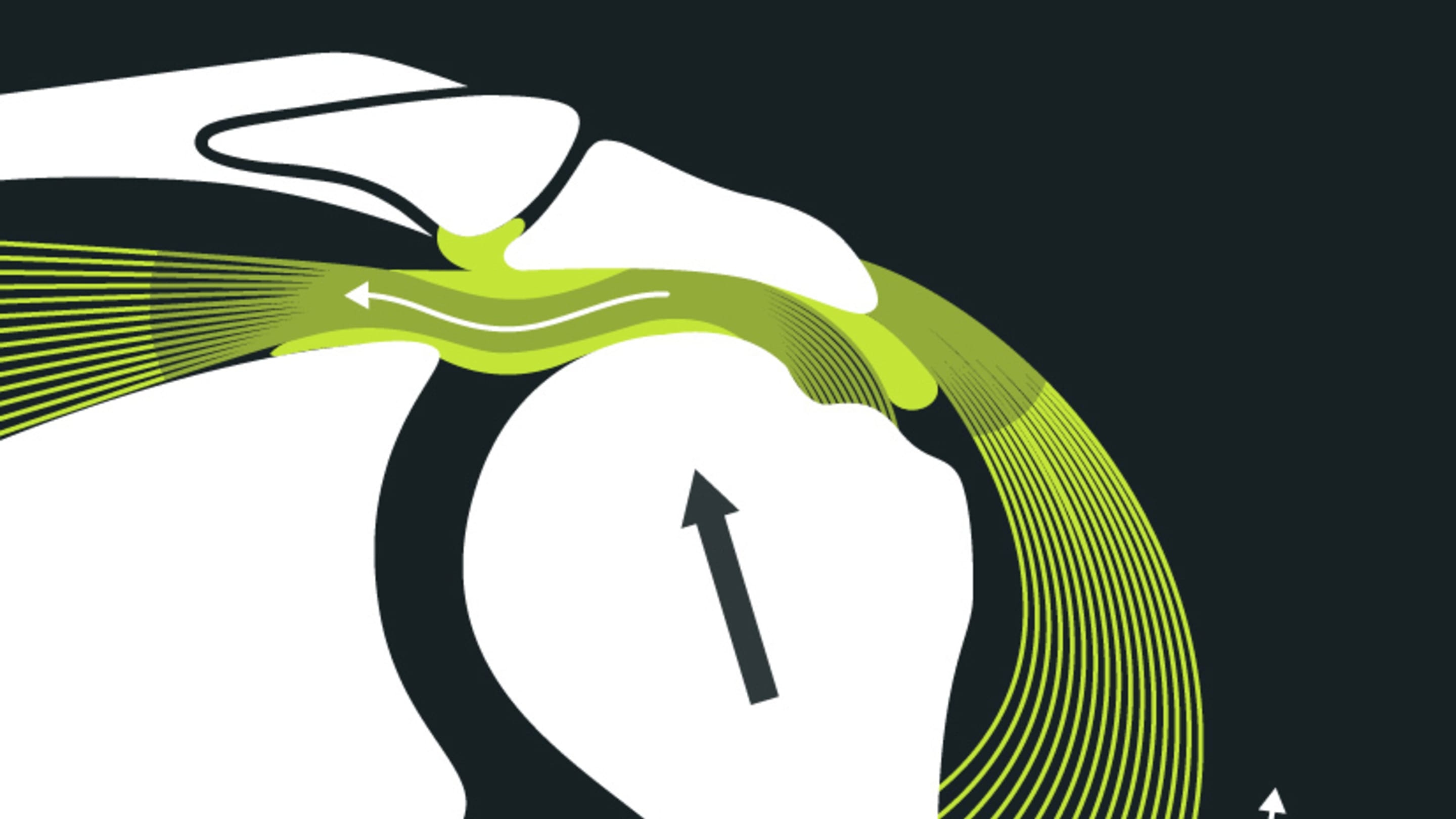 Was ist ein impingementsydrnom blackroll