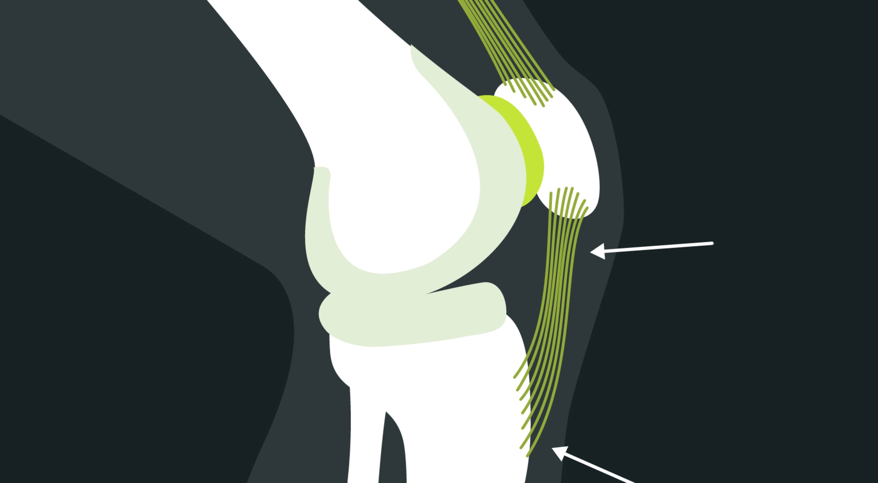 https://storage.googleapis.com/oneworld-prod/assets/anatomie-patellaspitzensyndrom-blackroll.jpg?v=1603300449