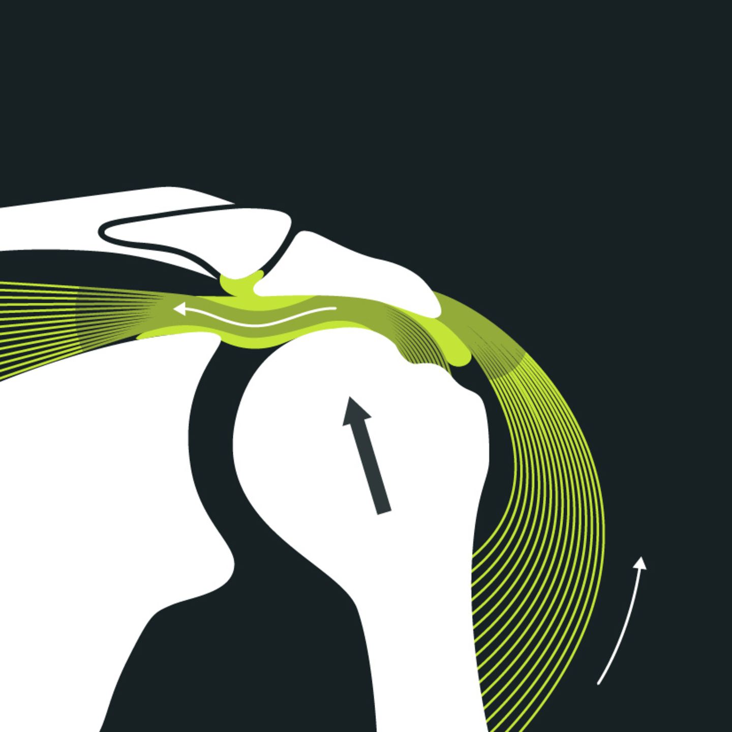 Was ist ein impingementsydrnom blackroll