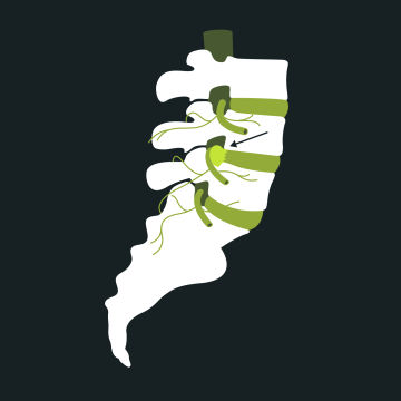 Anatomie bandscheibe lendenwirbel kreuzbein blackroll