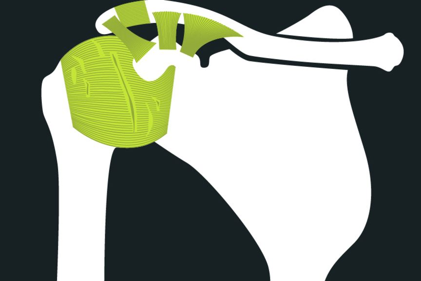 Anatomie eine Frozen Shoulder